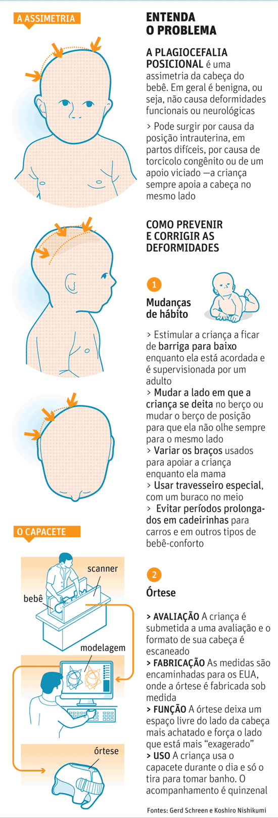 Criança com cabeça assimétrica – Plagiocefalia – pode ser tratada com  capacete – Rede Nacional Primeira Infância